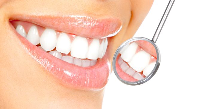 Mitos & verdades sobre el Blanqueamiento Dental